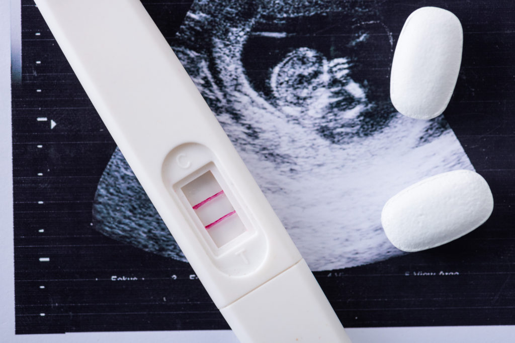 Como abortar en Francia: Test de embarazo positivo en Francia